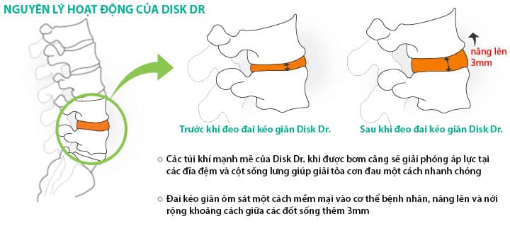 Hiệu quả kéo giãn cột sống của DiskDr