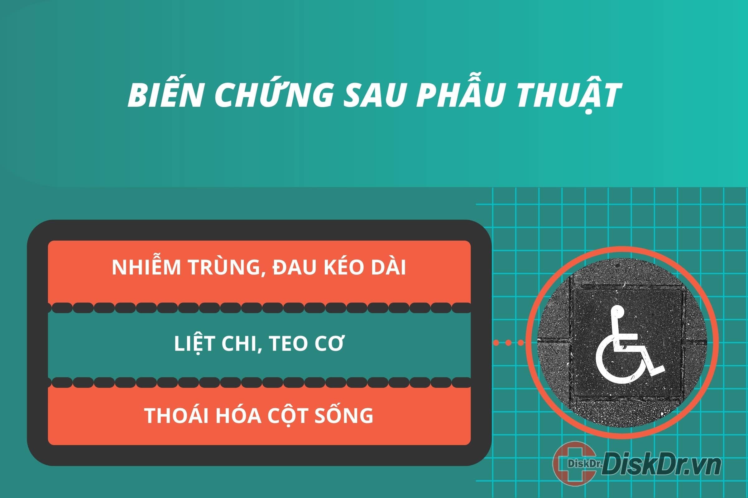 Biến chứng sau phẫu thuật thoát vị đĩa đệm