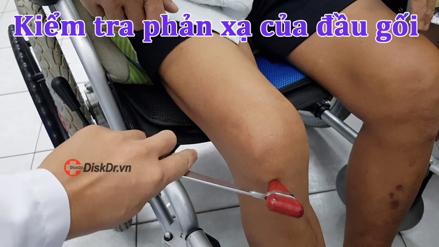 Kiểm tra phản xạ của đầu gối