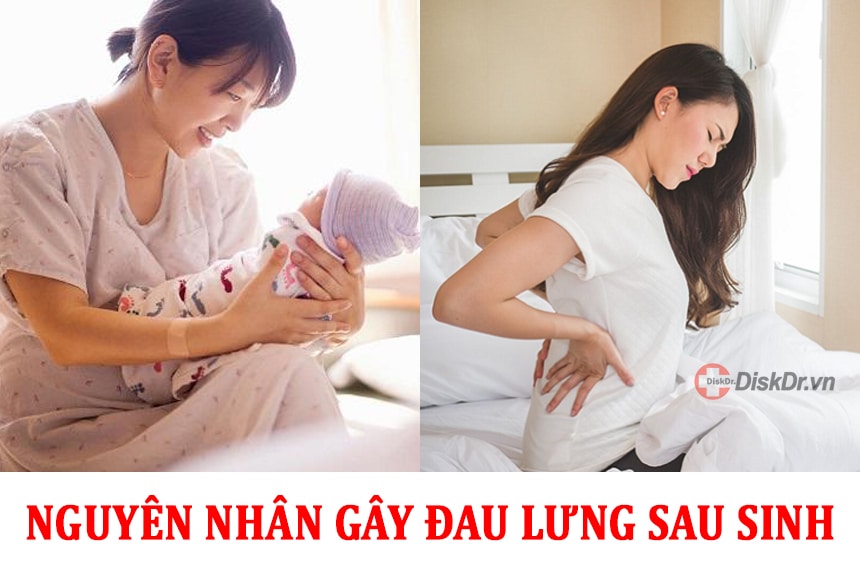 Nguyên nhân gây ra những cơn đau lưng sau khi sinh