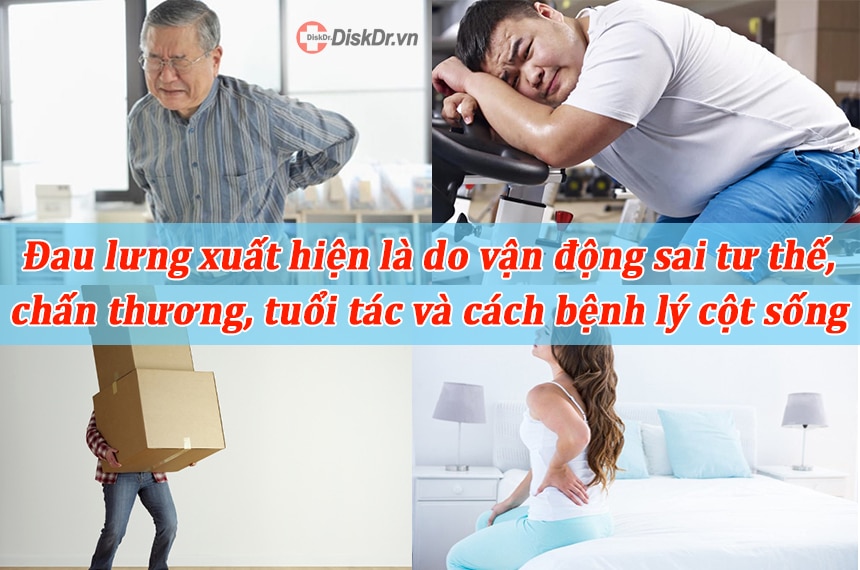 Đau lưng có thể xuất hiện do nhiều nguyên nhân khác nhau