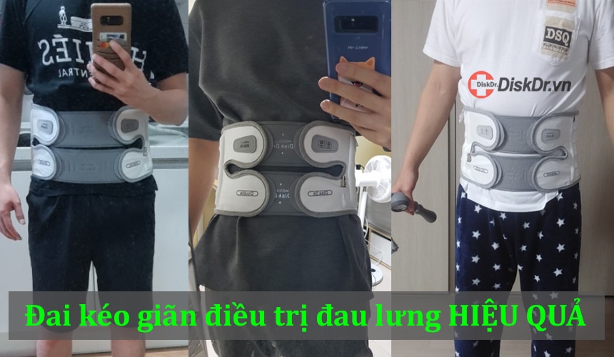 Nhiều khách hàng điều trị đau lưng HIỆU QUẢ bằng đai kéo giãn DiskDr