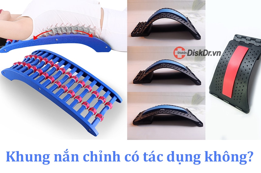 Khung nắn chỉnh không có tác dụng trong điều trị bệnh lâu dài