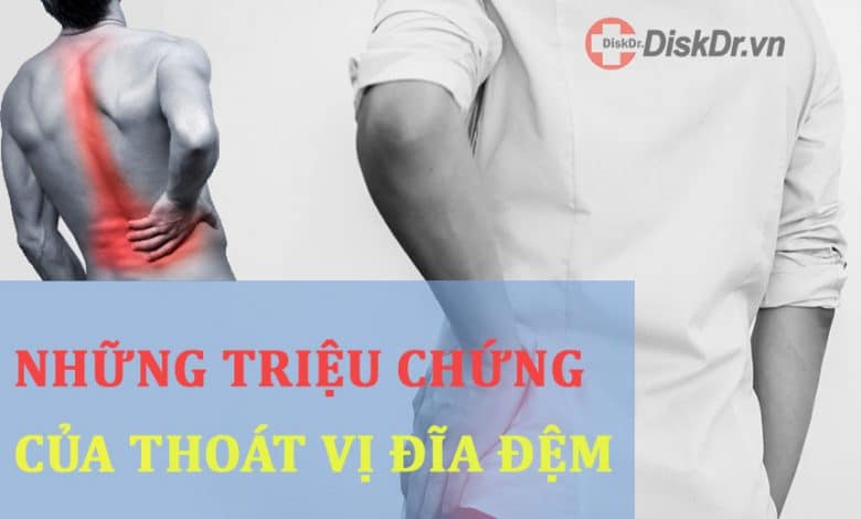 Những triệu chứng cơ bản của thoát vị đĩa đệm