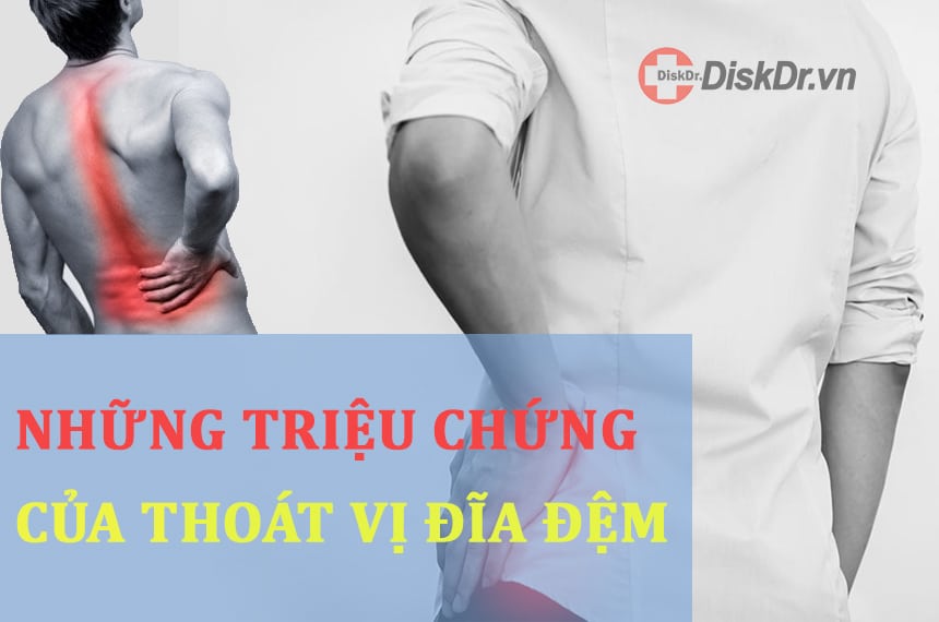 Những triệu chứng cơ bản của thoát vị đĩa đệm