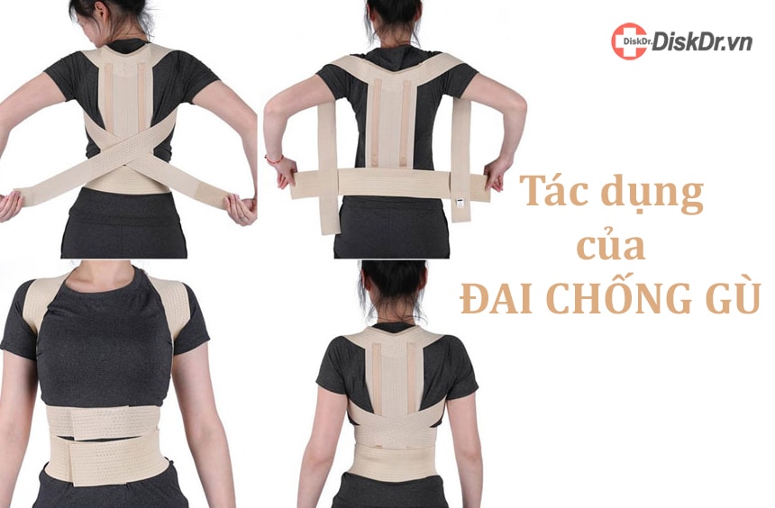 Tác dụng của đai chống gù, đai trị lưng tôm và cong cột sống