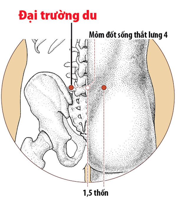 Điều trị đau lưng bằng bấm huyệt đại trường du