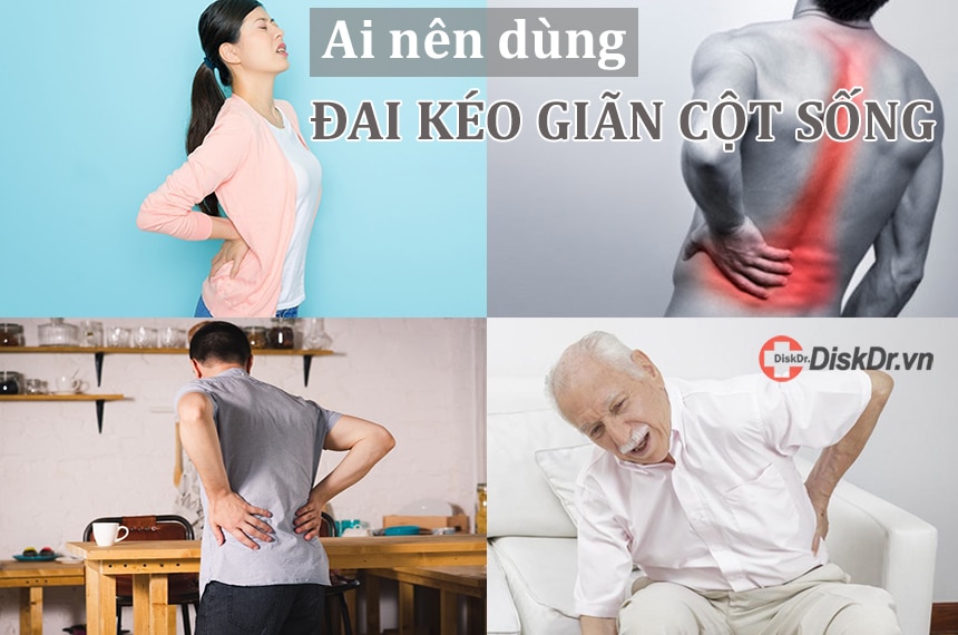 Ai nên dùng đai kéo giãn cột sống