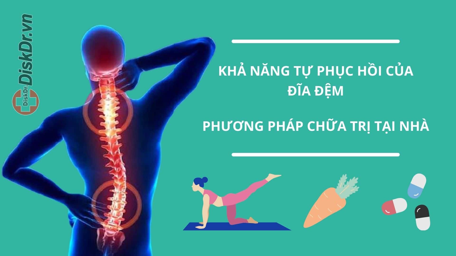 Chữa thoát vị đĩa đệm tại nhà và khả năng phục hồi đĩa đệm