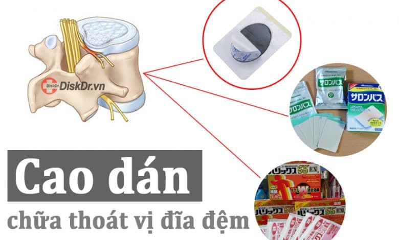 Cao dán chữa thoát vị đĩa đệm