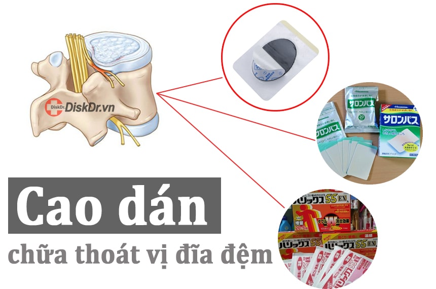 Cao dán chữa thoát vị đĩa đệm