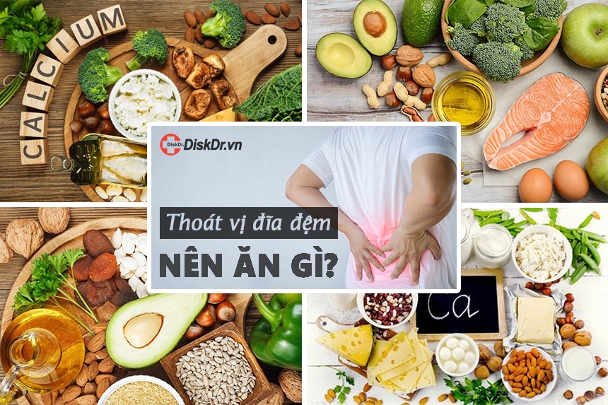 Thoát vị đĩa đệm nên ăn gì