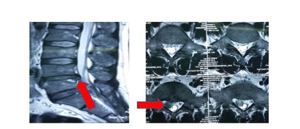 Chụp cộng hưởng từ MRI