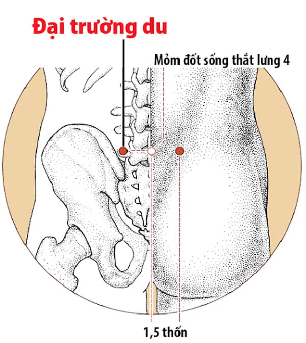 Huyệt đại trường du chữa thoát vị đĩa đệm