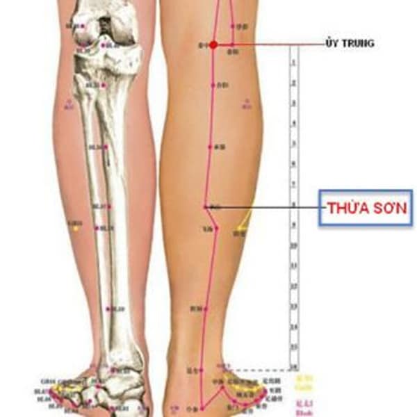 Huyệt thừa sơn giúp điều trị thoát vị đĩa đệm