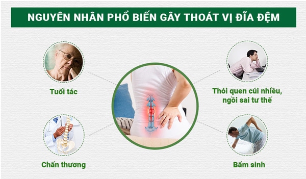 Nguyên nhân gây thoát vị đĩa đệm