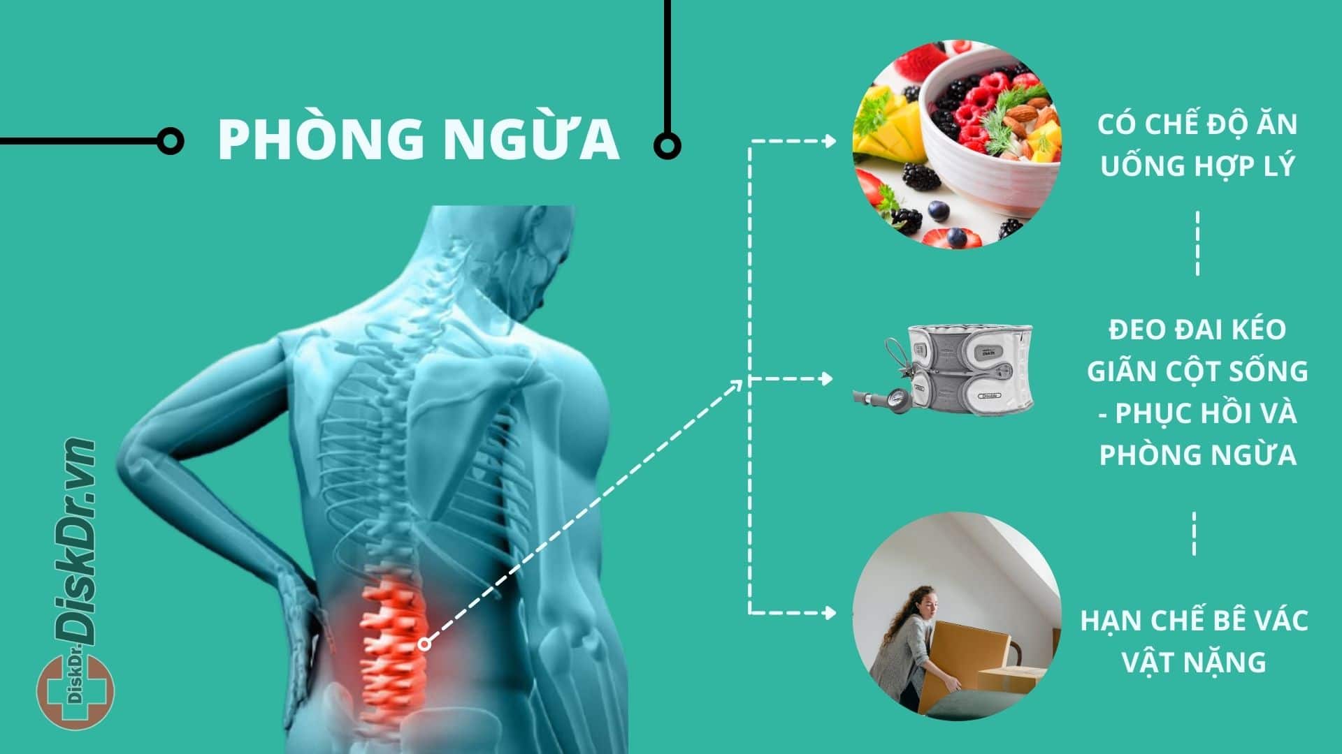 Cách phòng bệnh thoát vị đĩa đệm cột sống thắt lưng