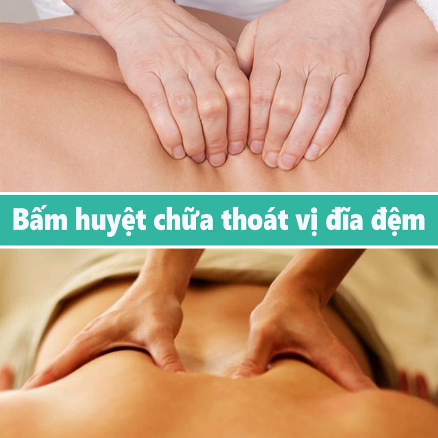 Bấm huyệt chữa thoát vị đĩa đệm