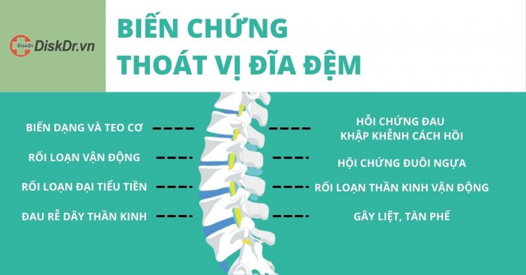 Thoát vị đĩa đệm có nguy hiểm không?