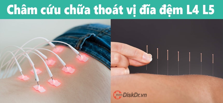 Phòng bệnh thoát vị đĩa đệm L4 L5 hiệu quả bằng đai kéo giãn DiskDr