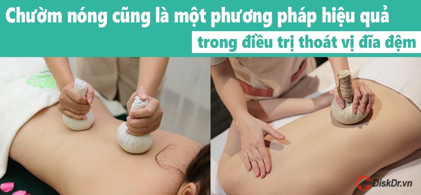 Chườm nóng hiệu quả trong điều trị thoát vị đĩa đệm