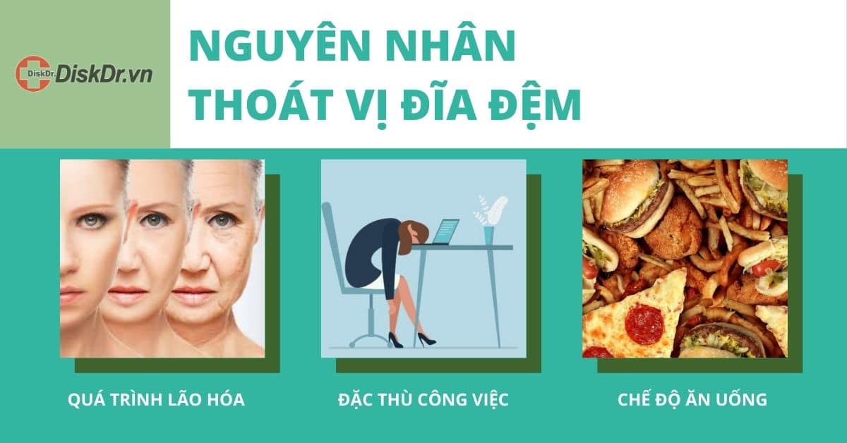 Nguyên nhân thoát vị đĩa đệm lưng, cổ