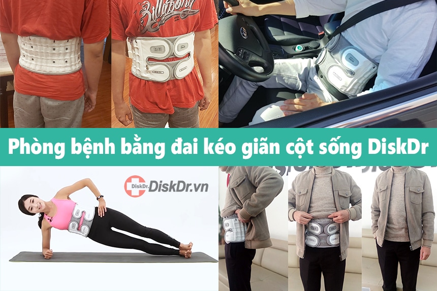 Phòng bệnh thoát vị đĩa đệm L4 L5 hiệu quả bằng đai kéo giãn DiskDr