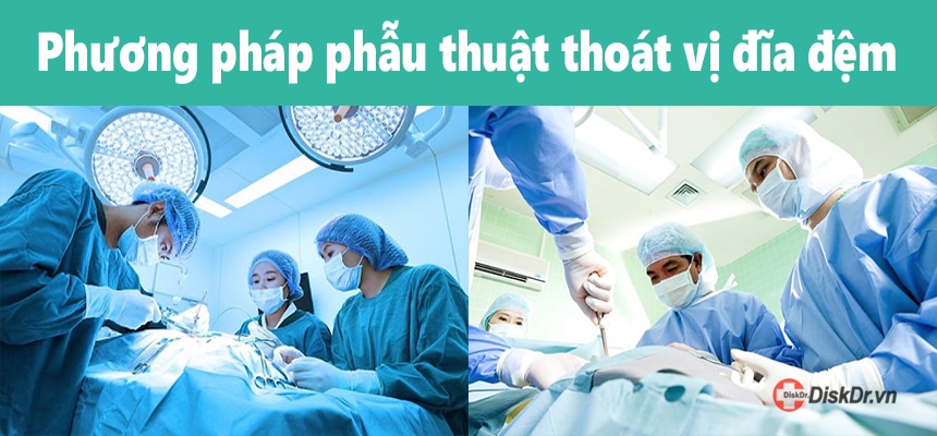 Phương pháp phẫu thuật thoát vị đĩa đệm