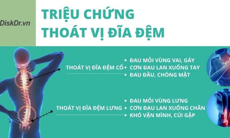 Triệu chứng thoát vị đĩa đệm nguy hiểm như nào?