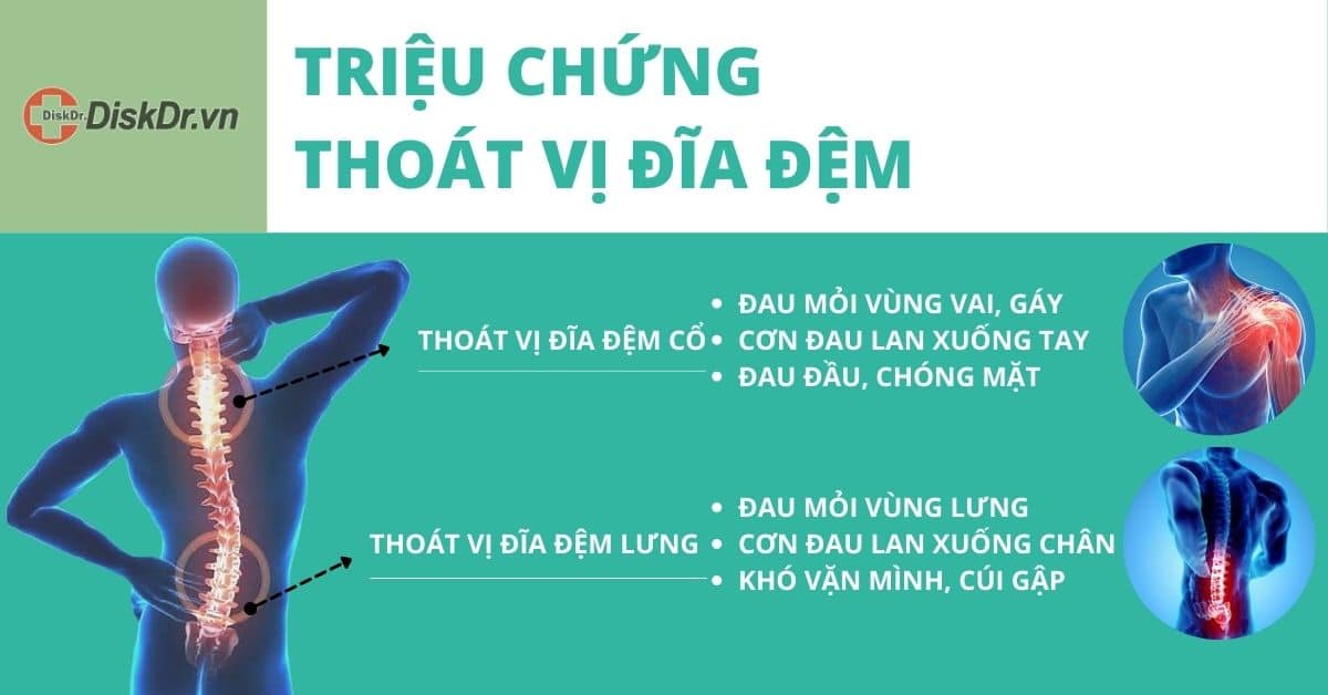 Triệu chứng thoát vị đĩa đệm nguy hiểm như nào?