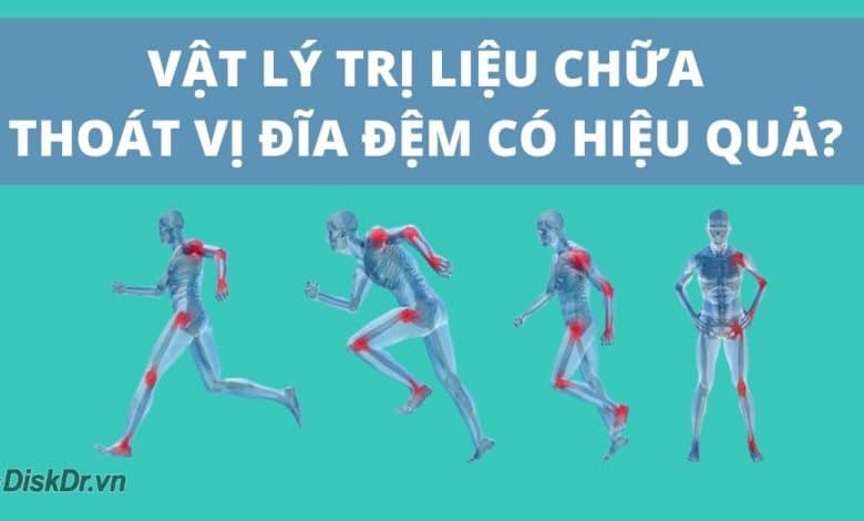 Vật lý trị liệu chữa thoát vị đĩa đệm