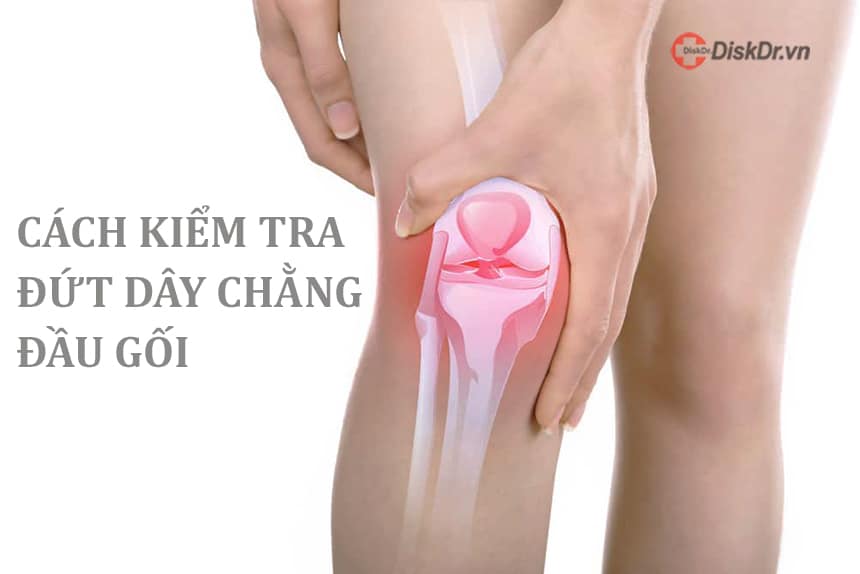 Những cách kiểm tra đứt dây chằng đầu gối