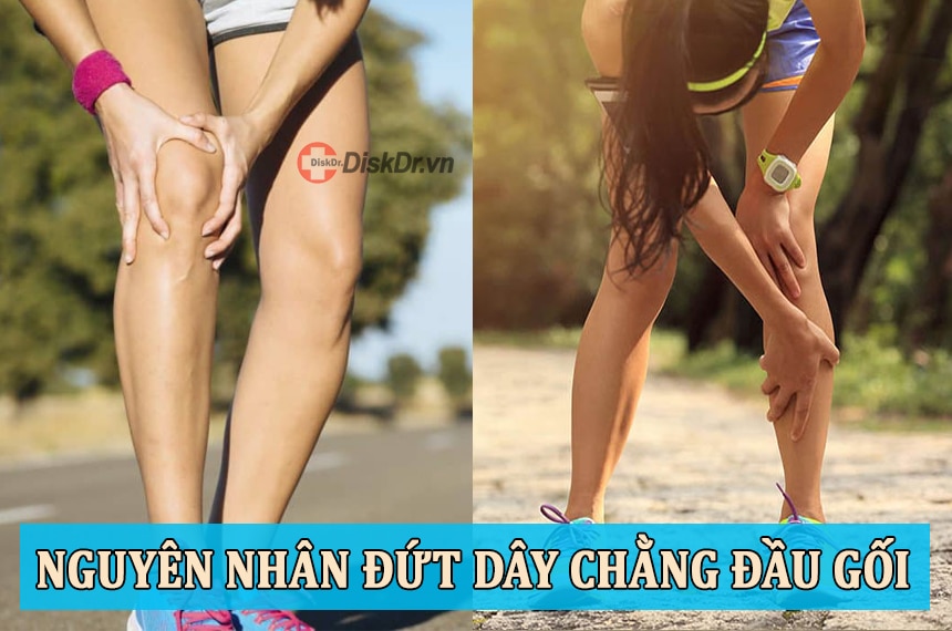 Những nguyên nhân gây ra đứt dây chằng đầu gối