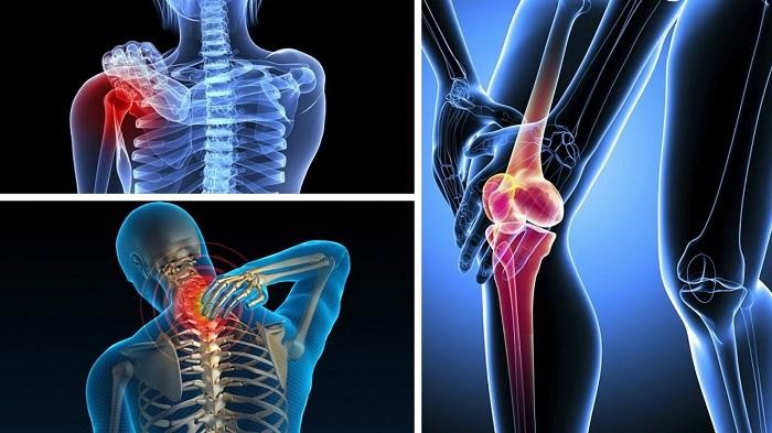 Các bệnh xương khớp thường gặp ở Việt Nam