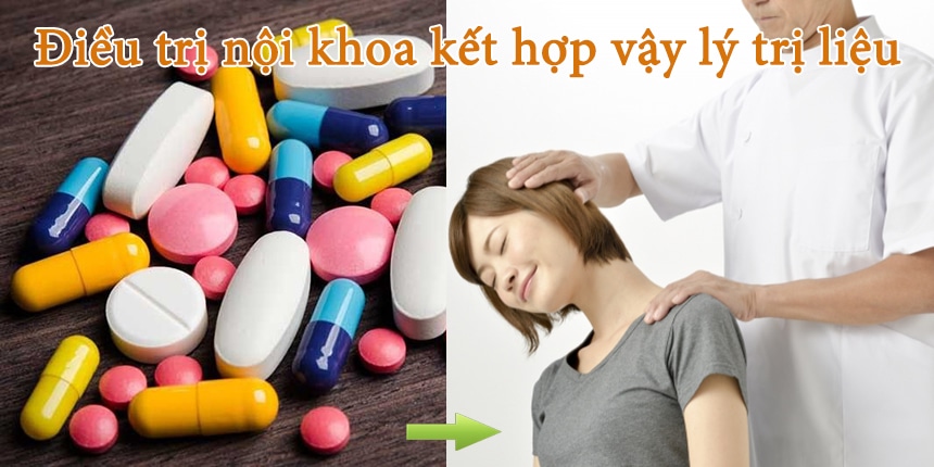 Điều trị nội khoa kết hợp vật lý trị liệu