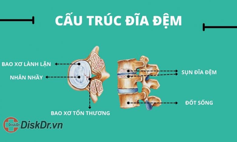 đĩa đệm có cấu trúc như thế nào?