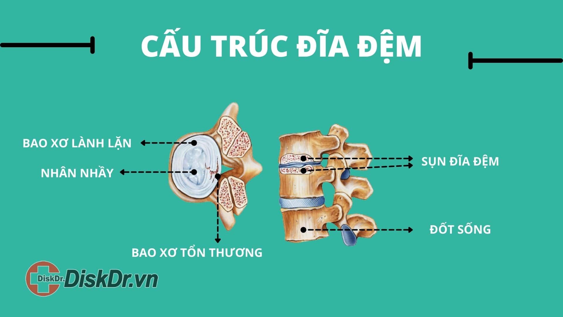 Đĩa đệm có cấu trúc như thế nào?