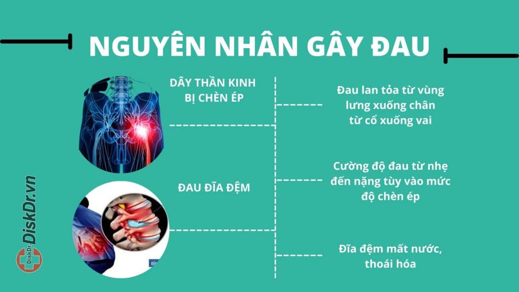 Nguyên nhân thoát vị đĩa đệm là gì?