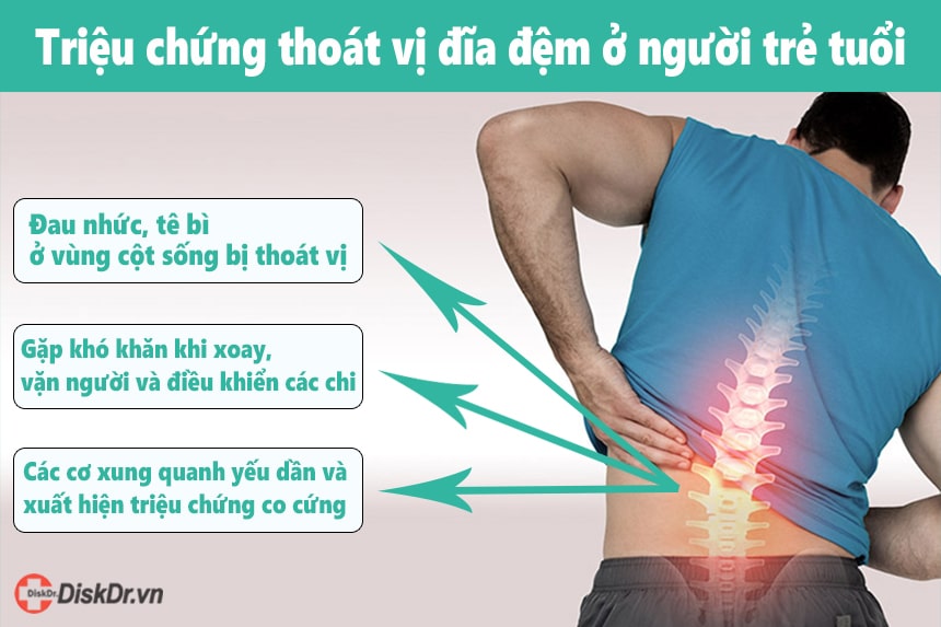 Triệu chứng thoát vị đĩa đệm ở người trẻ