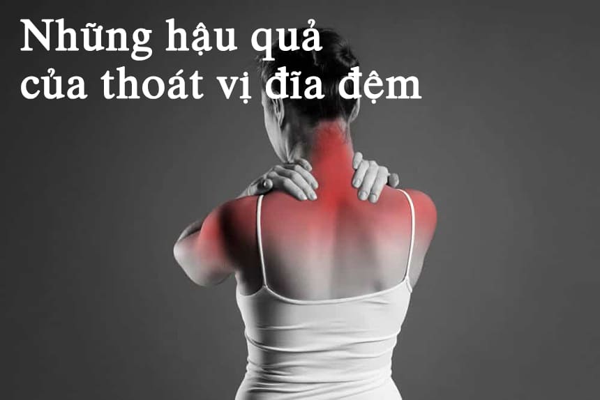 Những hậu quả của thoát vị đĩa đệm