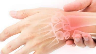 Chấn thương cổ tay khi chơi thể thao