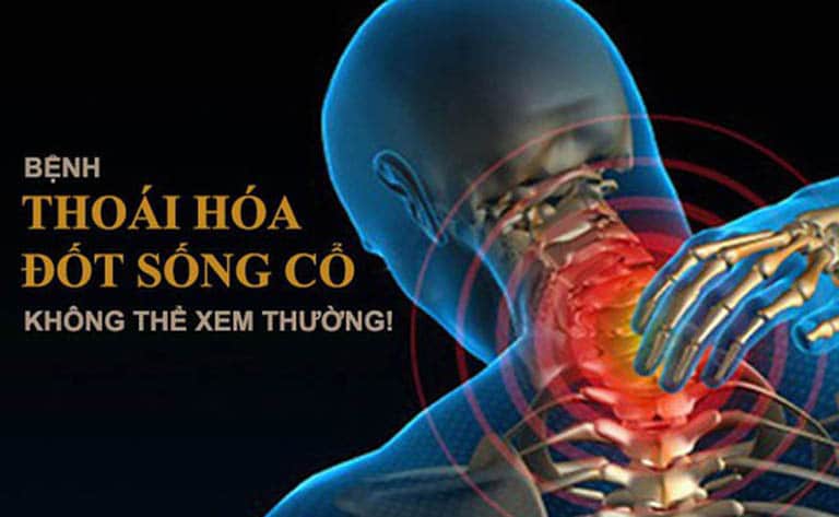 Thoái hóa đốt sống cổ sẽ gây ra đau nhức vai gáy