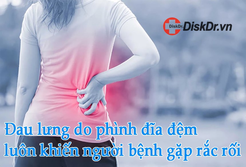 Đau lưng do phình đĩa đệm luôn khiến người bệnh gặp rắc rối