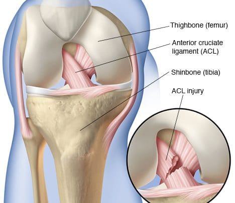 Vai trò quan trọng của dây chằng đầu gối