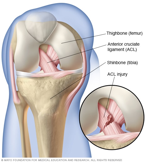 Vai trò quan trọng của dây chằng đầu gối