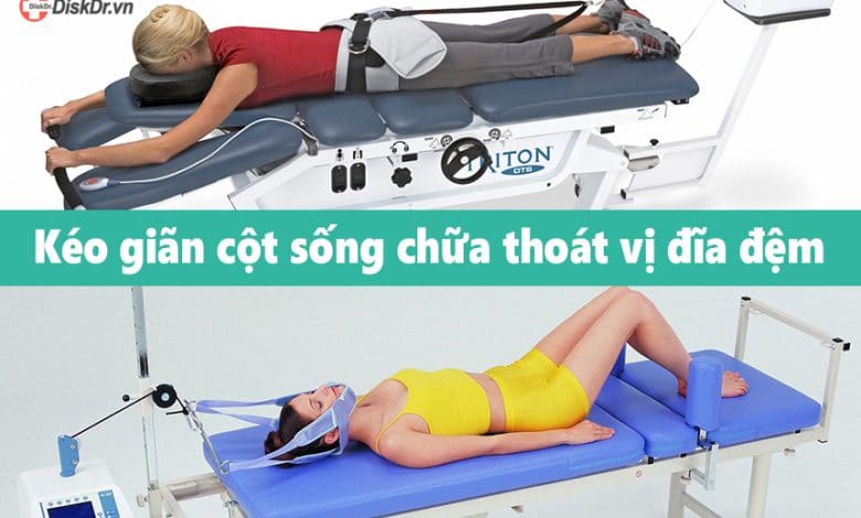 Kéo giãn cột sống chữa thoát vị đĩa đệm