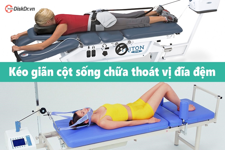 Kéo giãn cột sống chữa thoát vị đĩa đệm