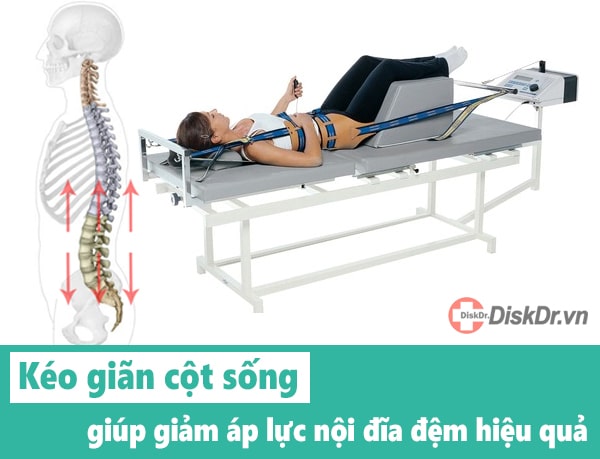 Kéo giãn cột sống làm giảm áp lực nội đĩa đệm