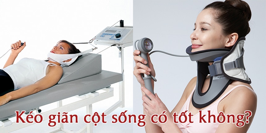 Phương pháp vật lý trị liệu được sử dụng nhiều nhất là kéo giãn cột sống