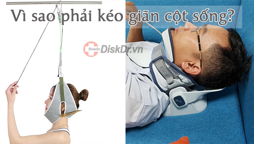 Vì sao phải kéo giãn cột sống?